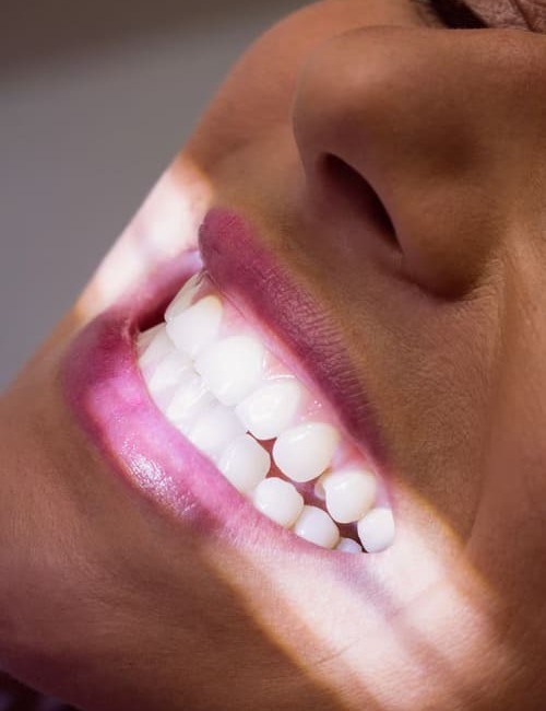 dental white